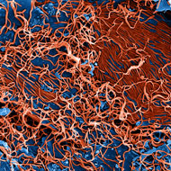 ebola particles
