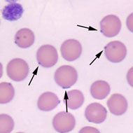 haemoplasma