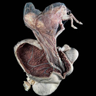 Winning image of pregnant pony's uterus