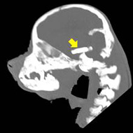 microchip in dog's brain