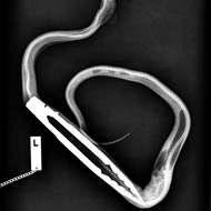Pet python ingests BBQ tongs