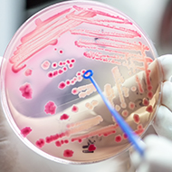 New tool launched to improve antimicrobial use