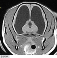 Study reveals gaps in epilepsy guidance compliance 