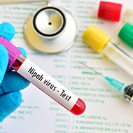 Research begins to develop single-shot Nipah virus vaccine