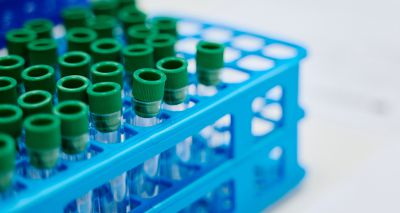 RVC's Oncobiome Bank to improve cancer care