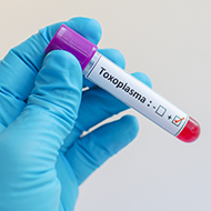 Pigs may offer insight into toxoplasma infection