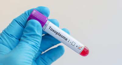 Pigs may offer insight into toxoplasma infection