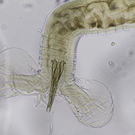 Webinar to explore Haemonchus treatment decisions