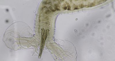 Webinar to explore Haemonchus treatment decisions