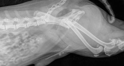Study suggests urolithiasis risk with PPVH